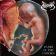 APOPLEXY - Tears Of The Unborn / Dysmorphophobia - CD